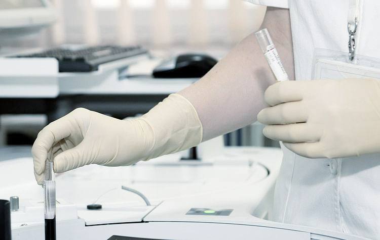 PSA TEST Prostatakrebs